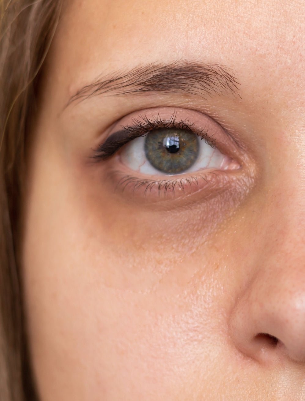 How to Prevent and Treat Dark Circles and Puffiness Around the Eyes - Caire Beauty