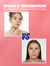 Melasma vs. Hyperpigmentation: Key Differences, Causes, and Treatments - Caire Beauty