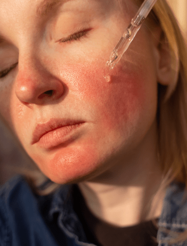 Retinol vs Niacinamide: Key Differences and How to Use Them - Caire Beauty