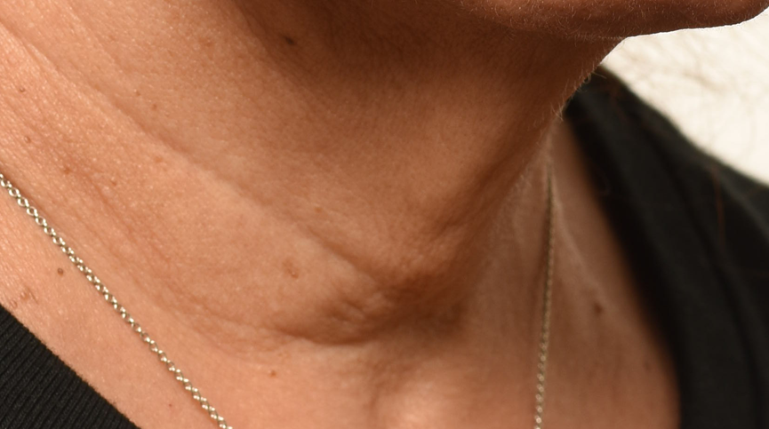 Skin after four weeks of use