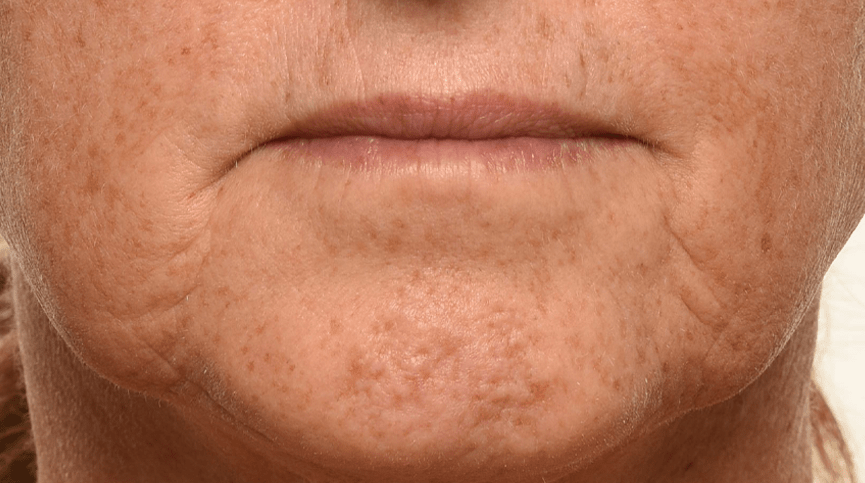 Full Size Trio: Theorem Serum Boost 30mL | 1oz + Triple Lift Molecule Mask 40 mL | 1.25oz + Grownup Moisturizer 50 mL | 1.7oz