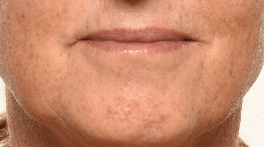 Full Size Trio: Theorem Serum Boost 30mL | 1oz + Triple Lift Molecule Mask 40 mL | 1.25oz + Grownup Moisturizer 50 mL | 1.7oz