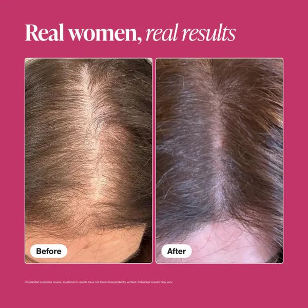 Viviscal Hair Growth Supplement - 15 - Day Starter Pack