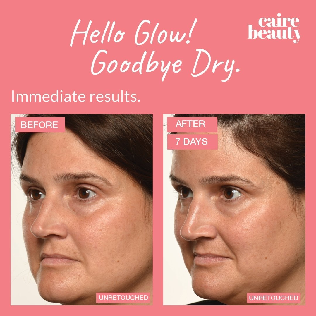 Theorem Serum Boost Travel Sizes